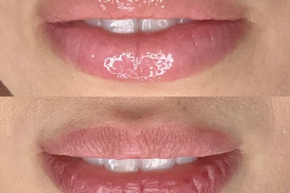 Lábios em detalhe para Hidra Gloss