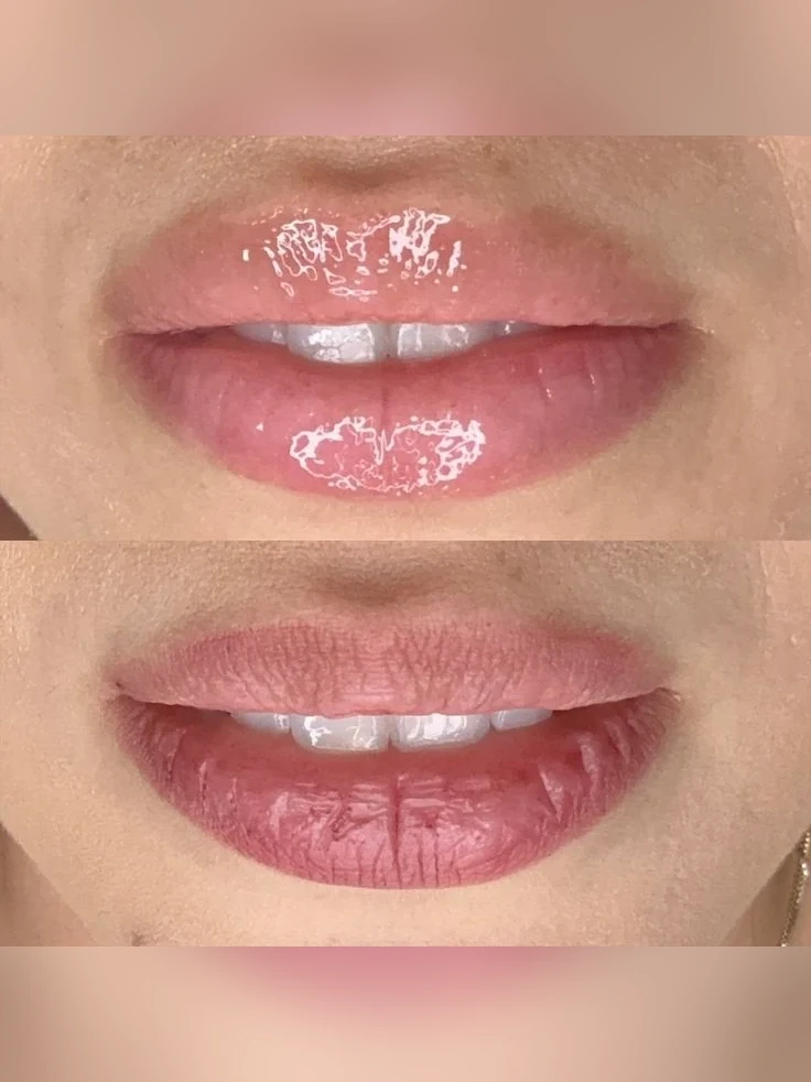 Imagem do curso de Hidra Gloss