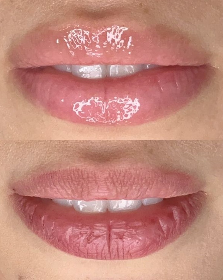 Lábios em detalhe para Hidra Gloss